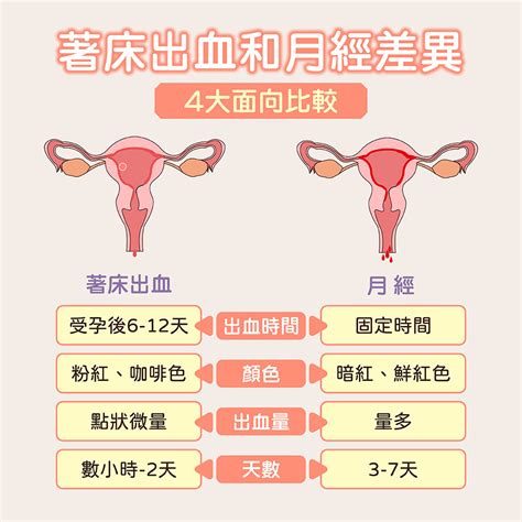 著床|著床出血是懷孕的徵兆？婦科醫師林思宏指出3要點判。